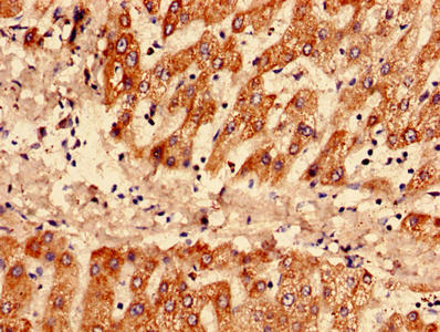 SAA1 / SAA / Serum Amyloid A Antibody - Immunohistochemistry of paraffin-embedded human liver tissue using SAA1 Antibody at dilution of 1:100