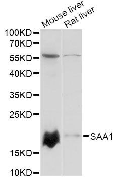 SAA1 / SAA / Serum Amyloid A Antibody - Western blot analysis of extracts of various cell lines, using SAA1 antibody at 1:3000 dilution. The secondary antibody used was an HRP Goat Anti-Rabbit IgG (H+L) at 1:10000 dilution. Lysates were loaded 25ug per lane and 3% nonfat dry milk in TBST was used for blocking. An ECL Kit was used for detection and the exposure time was 30s.