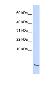 SAA4 Antibody - SAA4 antibody Western blot of Fetal Lung lysate. This image was taken for the unconjugated form of this product. Other forms have not been tested.