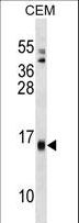 SAA4 Antibody - SAA4 Antibody western blot of CEM cell line lysates (35 ug/lane). The SAA4 antibody detected the SAA4 protein (arrow).