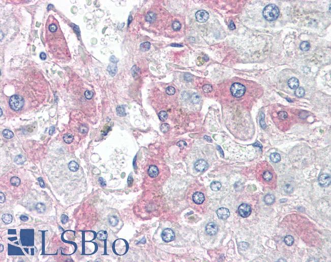SAA4 Antibody - Anti-SAA4 antibody IHC of human liver. Immunohistochemistry of formalin-fixed, paraffin-embedded tissue after heat-induced antigen retrieval. Antibody dilution 5-10 ug/ml. This image was taken for the unconjugated form of this product. Other forms have not been tested.
