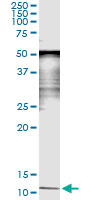 SAA4 Antibody - Immunoprecipitation of SAA4 transfected lysate using anti-SAA4 monoclonal antibody and Protein A Magnetic Bead, and immunoblotted with SAA4 rabbit polyclonal antibody.