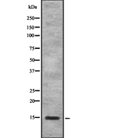 SAA4 Antibody - Western blot analysis of SAA4 using HeLa whole lysates.