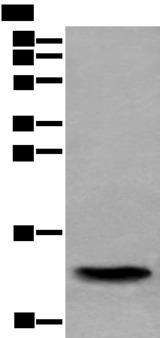 SAA4 Antibody - Western blot analysis of Human normal stomach tissue lysate  using SAA4 Polyclonal Antibody at dilution of 1:350