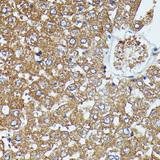 SAA4 Antibody - Immunohistochemistry of paraffin-embedded Rat liver using SAA4 Polyclonal Antibody at dilution of 1:100 (40x lens).