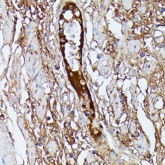 SAA4 Antibody - Immunohistochemistry of paraffin-embedded Human plasma using SAA4 Polyclonal Antibody at dilution of 1:100 (40x lens).