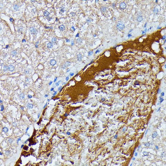 SAA4 Antibody - Immunohistochemistry of paraffin-embedded Mouse liver using SAA4 Polyclonal Antibody at dilution of 1:100 (40x lens).