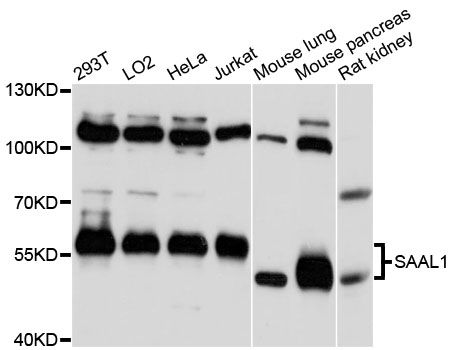 SAAL1 Antibody - Western blot analysis of extracts of various cell lines, using SAAL1 antibody at 1:3000 dilution. The secondary antibody used was an HRP Goat Anti-Rabbit IgG (H+L) at 1:10000 dilution. Lysates were loaded 25ug per lane and 3% nonfat dry milk in TBST was used for blocking. An ECL Kit was used for detection and the exposure time was 10s.