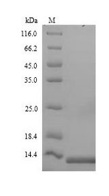 ACB1 Protein - (Tris-Glycine gel) Discontinuous SDS-PAGE (reduced) with 5% enrichment gel and 15% separation gel.