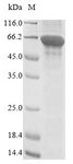 Acetyl-CoA Carboxylase / ACC Protein - (Tris-Glycine gel) Discontinuous SDS-PAGE (reduced) with 5% enrichment gel and 15% separation gel.