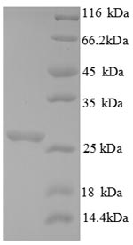 Chitin Synthase CHS1 Protein - (Tris-Glycine gel) Discontinuous SDS-PAGE (reduced) with 5% enrichment gel and 15% separation gel.