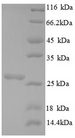 Chitin Synthase CHS1 Protein - (Tris-Glycine gel) Discontinuous SDS-PAGE (reduced) with 5% enrichment gel and 15% separation gel.