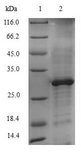 CYP51A1 / CYP51 Protein - (Tris-Glycine gel) Discontinuous SDS-PAGE (reduced) with 5% enrichment gel and 15% separation gel.