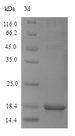 DPP9 Protein - (Tris-Glycine gel) Discontinuous SDS-PAGE (reduced) with 5% enrichment gel and 15% separation gel.