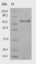 Exopolyphosphatase Protein - (Tris-Glycine gel) Discontinuous SDS-PAGE (reduced) with 5% enrichment gel and 15% separation gel.