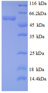 HK1 / Hexokinase 1 Protein