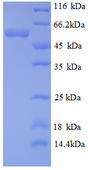 HK1 / Hexokinase 1 Protein