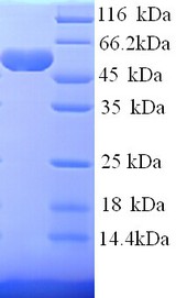 HK1 / Hexokinase 1 Protein