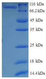 IFM1 Protein