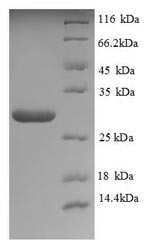 Neutral Trehalase Protein - (Tris-Glycine gel) Discontinuous SDS-PAGE (reduced) with 5% enrichment gel and 15% separation gel.