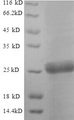 Neutral Trehalase Protein - (Tris-Glycine gel) Discontinuous SDS-PAGE (reduced) with 5% enrichment gel and 15% separation gel.