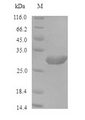 PCNA Protein - (Tris-Glycine gel) Discontinuous SDS-PAGE (reduced) with 5% enrichment gel and 15% separation gel.