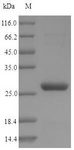 PNC1 Protein - (Tris-Glycine gel) Discontinuous SDS-PAGE (reduced) with 5% enrichment gel and 15% separation gel.