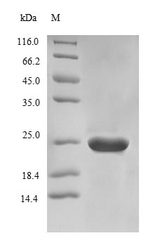 PNC1 Protein - (Tris-Glycine gel) Discontinuous SDS-PAGE (reduced) with 5% enrichment gel and 15% separation gel.