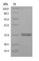 RAB1B Protein - (Tris-Glycine gel) Discontinuous SDS-PAGE (reduced) with 5% enrichment gel and 15% separation gel.