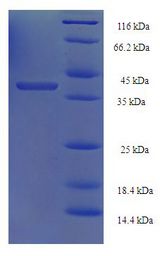 RAD52 Protein