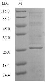 RAN Protein - (Tris-Glycine gel) Discontinuous SDS-PAGE (reduced) with 5% enrichment gel and 15% separation gel.