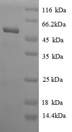 SAHH / AHCY Protein - (Tris-Glycine gel) Discontinuous SDS-PAGE (reduced) with 5% enrichment gel and 15% separation gel.