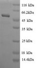 SAHH / AHCY Protein - (Tris-Glycine gel) Discontinuous SDS-PAGE (reduced) with 5% enrichment gel and 15% separation gel.