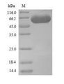 SES1 Protein - (Tris-Glycine gel) Discontinuous SDS-PAGE (reduced) with 5% enrichment gel and 15% separation gel.