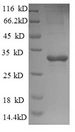 TPS2 / Trehalose-Phosphatase Protein - (Tris-Glycine gel) Discontinuous SDS-PAGE (reduced) with 5% enrichment gel and 15% separation gel.