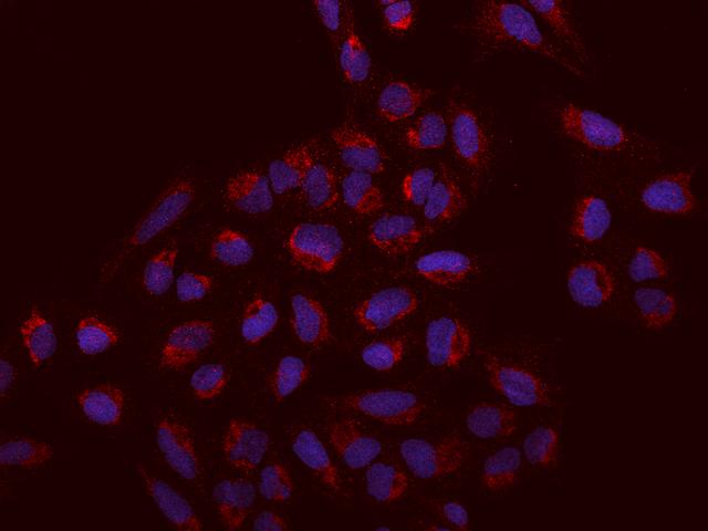 SACM1L / SAC1 Antibody - Immunofluorescence staining of SACM1L in U2OS cells. Cells were fixed with 4% PFA, permeabilzed with 0.1% Triton X-100 in PBS, blocked with 10% serum, and incubated with rabbit anti-Human SACM1L polyclonal antibody (dilution ratio 1:200) at 4°C overnight. Then cells were stained with the Alexa Fluor 594-conjugated Goat Anti-rabbit IgG secondary antibody (red) and counterstained with DAPI (blue). Positive staining was localized to Cytoplasm.