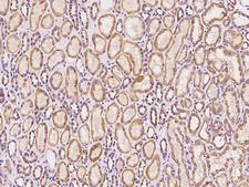 SACM1L / SAC1 Antibody - Immunochemical staining of human SACM1L in human kidney with rabbit polyclonal antibody at 1:100 dilution, formalin-fixed paraffin embedded sections.