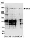 SACS / Sacsin Antibody - Detection of human and mouse SACS by western blot. Samples: Whole cell lysate (50 µg) from HeLa, HEK293T, Jurkat, mouse TCMK-1, and mouse NIH 3T3 cells prepared using NETN lysis buffer. Antibody: Affinity purified rabbit anti-SACS antibody used for WB at 0.1 µg/ml. Detection: Chemiluminescence with an exposure time of 30 seconds.