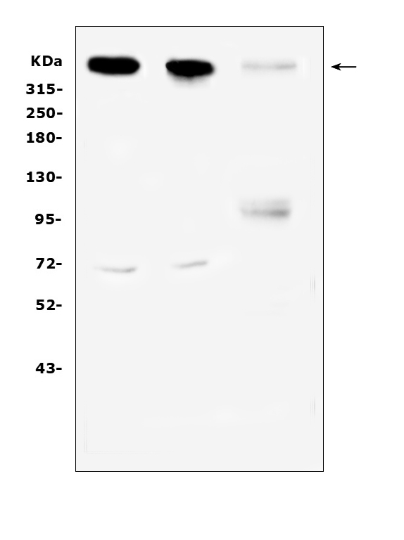 SACS / Sacsin Antibody - Western blot analysis of Sacsin using anti-Sacsin antibody. Electrophoresis was performed on a 5-20% SDS-PAGE gel at 70V (Stacking gel) / 90V (Resolving gel) for 2-3 hours. The sample well of each lane was loaded with 50ug of sample under reducing conditions. Lane 1: rat brain tissue lysates,Lane 2: mouse brain tissue lysates,Lane 3: human Hela cell lysates. After Electrophoresis, proteins were transferred to a Nitrocellulose membrane at 150mA for 50-90 minutes. Blocked the membrane with 5% Non-fat Milk/ TBS for 1.5 hour at RT. The membrane was incubated with rabbit anti-Sacsin antigen affinity purified polyclonal antibody at 0.5 µg/mL overnight at 4°C, then washed with TBS-0.1% Tween 3 times with 5 minutes each and probed with a goat anti-rabbit IgG-HRP secondary antibody at a dilution of 1:10000 for 1.5 hour at RT. The signal is developed using an Enhanced Chemiluminescent detection (ECL) kit with Tanon 5200 system. A specific band was detected for Sacsin at approximately 521KD. The expected band size for Sacsin is at 521KD.
