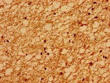 SACS / Sacsin Antibody - Immunohistochemistry image of paraffin-embedded human brain tissue at a dilution of 1:100
