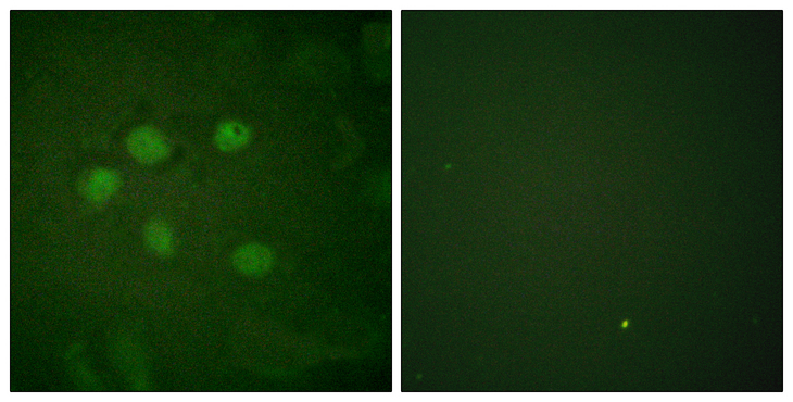 SAE1 Antibody - Immunofluorescence analysis of HUVEC cells, using AOS1 Antibody. The picture on the right is blocked with the synthesized peptide.
