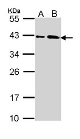 SAE1 Antibody - Sample (30 ug of whole cell lysate). A: A431 , B: H1299. 10% SDS PAGE. SAE1 antibody diluted at 1:1000.