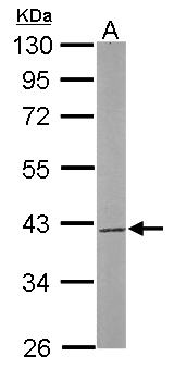 SAE1 Antibody - Sample (50 ug of whole cell lysate). A: Mouse brain. 10% SDS PAGE. SAE1 antibody diluted at 1:1000.