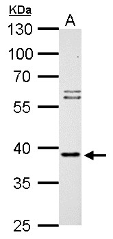 SAE1 Antibody - SAE1 antibody detects SAE1 protein by Western blot analysis. A. 30 ug Rat2 whole cell lysate/extract. 10 % SDS-PAGE. SAE1 antibody dilution:1:1000