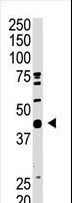 SAE1 Antibody - The AOS1 C-term antibody is used in Western blot to detect AOS1 in mouse heart tissue lysate.