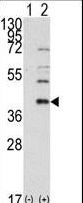 SAE1 Antibody - Western blot of AOS1 (arrow) using rabbit polyclonal AOS1 Antibody. 293 cell lysates (2 ug/lane) either nontransfected (Lane 1) or transiently transfected with the AOS1 gene (Lane 2) (Origene Technologies).