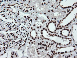 SAE1 Antibody - IHC of paraffin-embedded Human Kidney tissue using anti-SAE1 mouse monoclonal antibody.