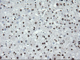 SAE1 Antibody - IHC of paraffin-embedded Human liver tissue using anti-SAE1 mouse monoclonal antibody.