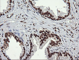 SAE1 Antibody - IHC of paraffin-embedded Human prostate tissue using anti-SAE1 mouse monoclonal antibody.