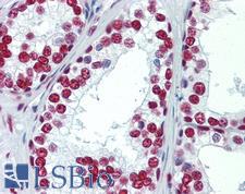 SAE1 Antibody - Anti-SAE1 antibody IHC staining of human prostate. Immunohistochemistry of formalin-fixed, paraffin-embedded tissue after heat-induced antigen retrieval.